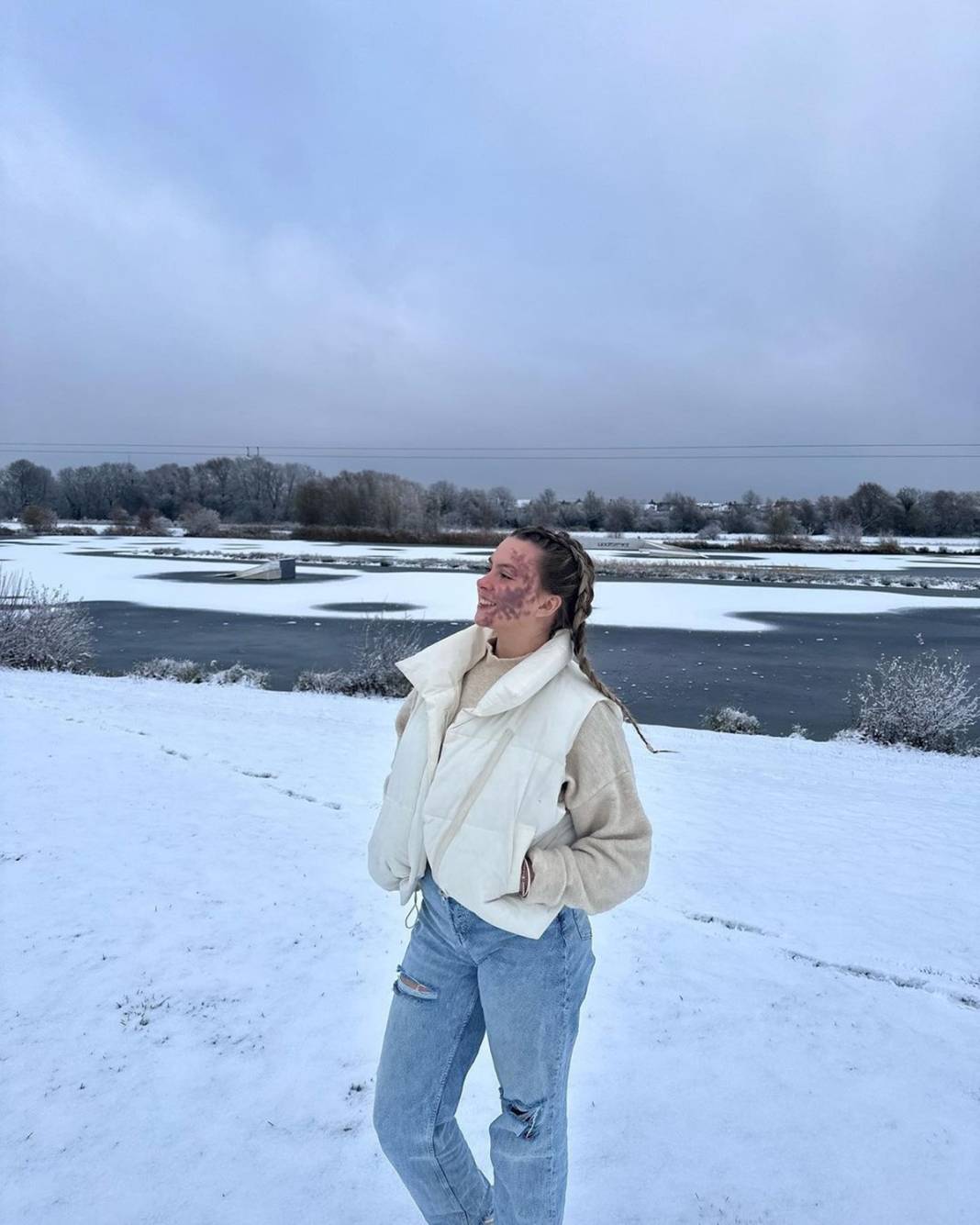 Basit bir uçuk zannetti, korkunç hastalığa yakalandı! Doktorlar bile teşhis koyamadı 24